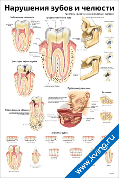 Плакат нарушения зубов и челюсти