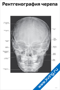 Плакат рентгенография черепа