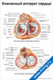 Плакат с подробной анатомической схемой клапанного аппарата сердца, включая аортальный, митральный, трёхстворчатый и лёгочный клапаны