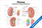 плакат почка строение и кровоснабжение с подробными анатомическими схемами и подписями для медицинского изучения