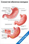 плакат слизистая оболочка желудка с подробной анатомией, схемами отделов желудка, пищевода и двенадцатиперстной кишки