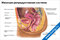 плакат с подробной схемой женской репродуктивной системы с подписями основных органов и анатомических элементов