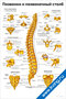 плакат с подробными анатомическими изображениями позвонков и позвоночного столба для медицинского изучения