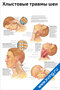 плакат с подробными медицинскими иллюстрациями и схемами, посвящённый хлыстовым травмам шеи, их причинам и последствиям