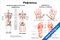 Плакат с подробной схемой нейролимфатических рефлексов и рефлексов кисти и стопы для медицинского изучения