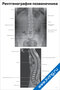 Плакат по рентгенографии позвоночника с подробными подписями анатомических структур, предназначенный для медицинского изучения