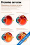 плакат по офтальмологии с иллюстрациями процесса отслойки сетчатки и образования разрывов сетчатки глаза